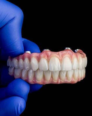 A close-up of a tooth with a dental implant.
