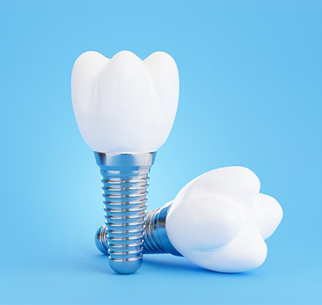 Dental implants on a blue background.